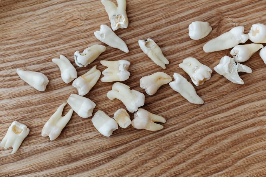Why Experts Now Say Not to Remove Your Wisdom Teeth